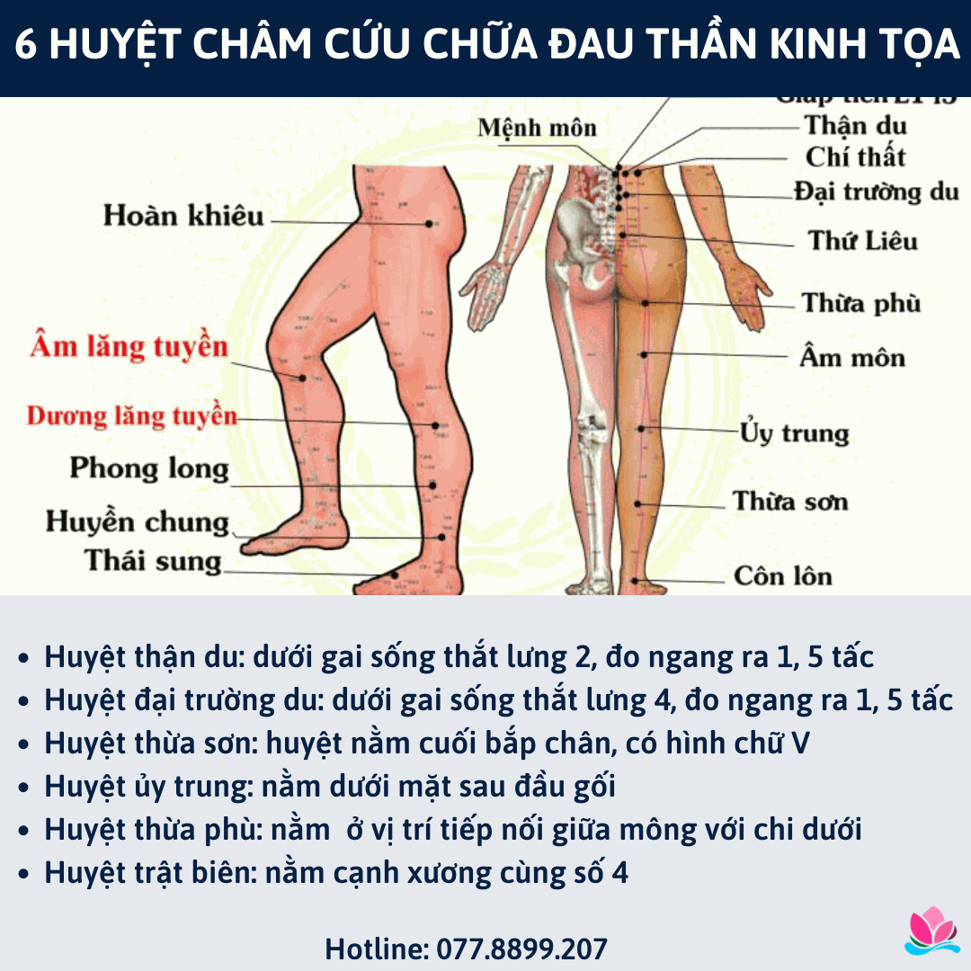 Odoo • Hình ảnh với chú thích