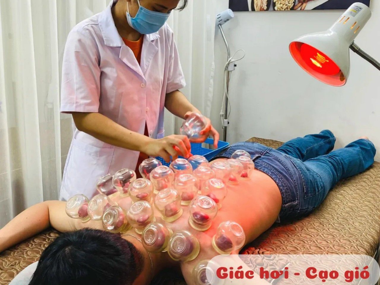 CẠO GIÓ GIÁC HƠI Ở ĐÂU? | Đông Y Hoa Sen