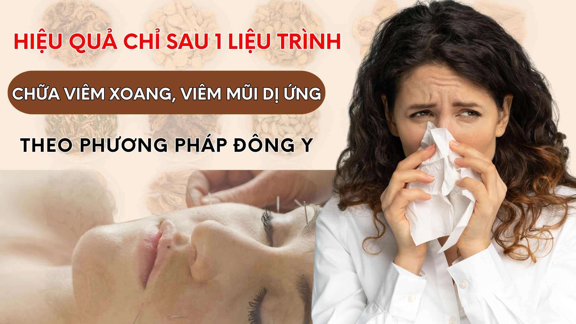 Odoo • Hình ảnh với chú thích